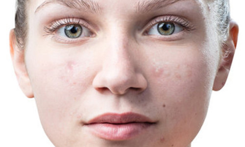 Portrait Retouching